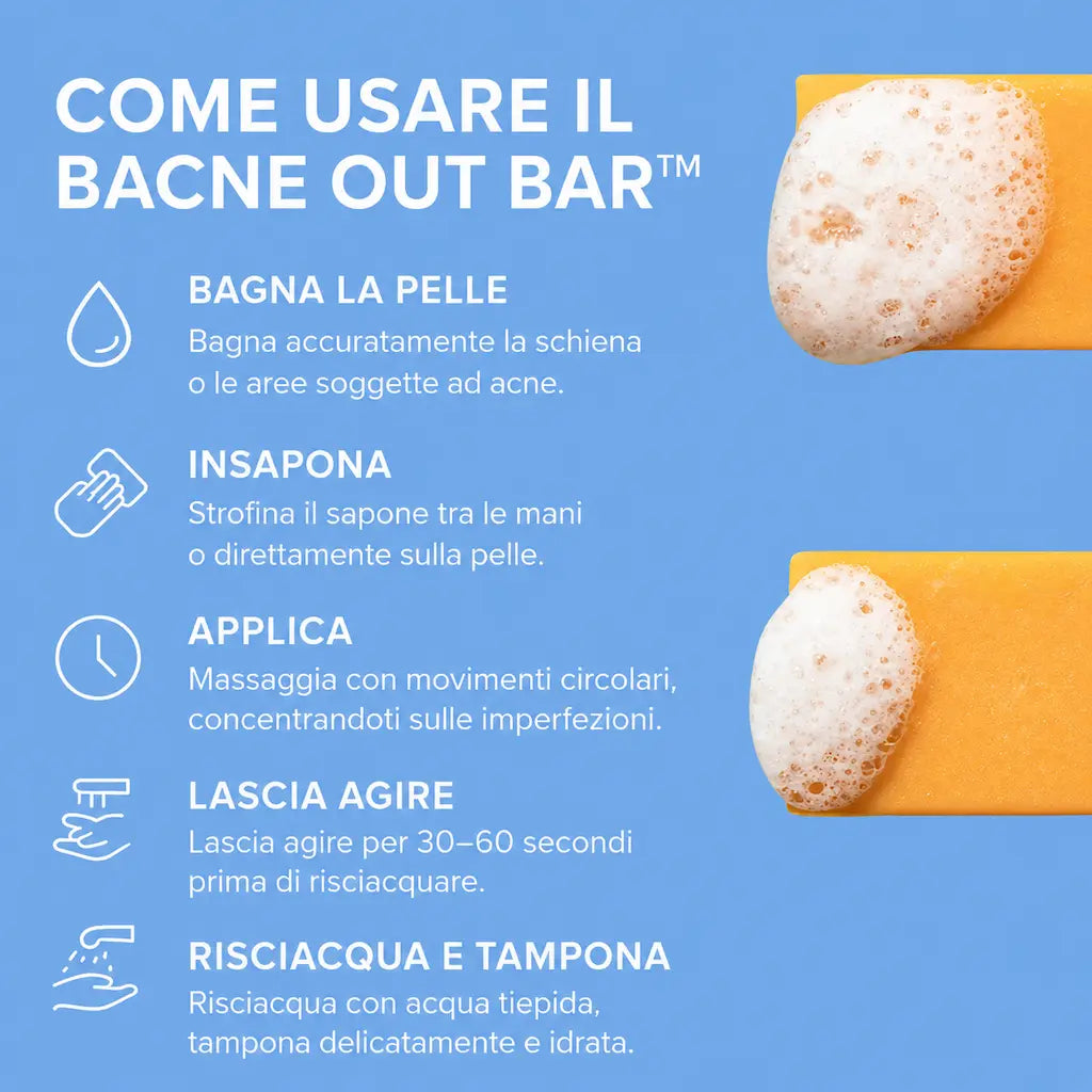Bacne - acne della schiena
