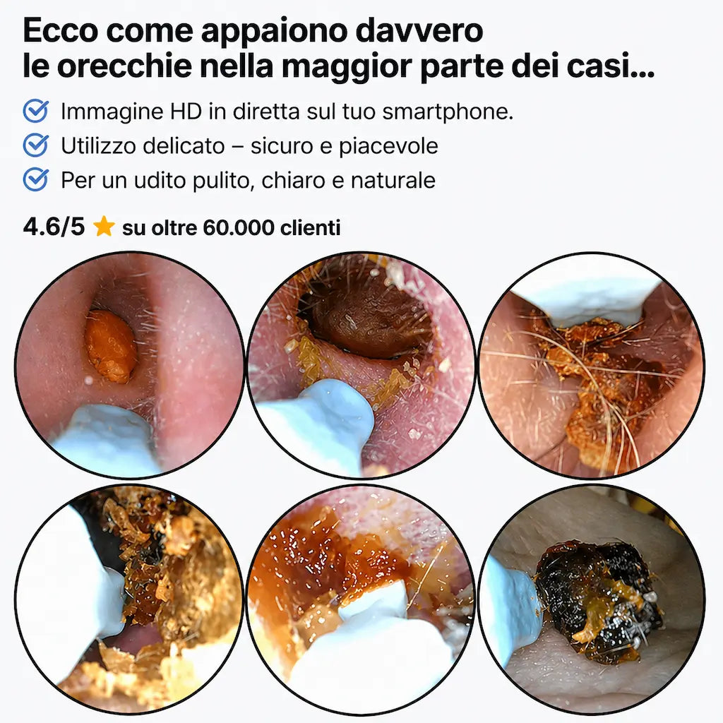 AurisCam - Pulitore auricolare digitale