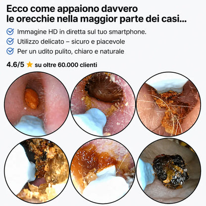 AurisCam - Pulitore auricolare digitale