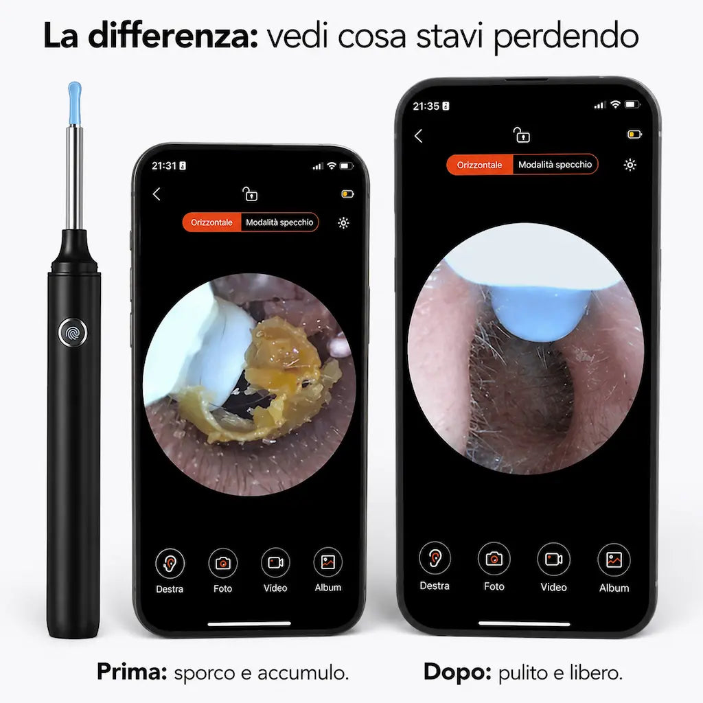 AurisCam - Pulitore auricolare digitale
