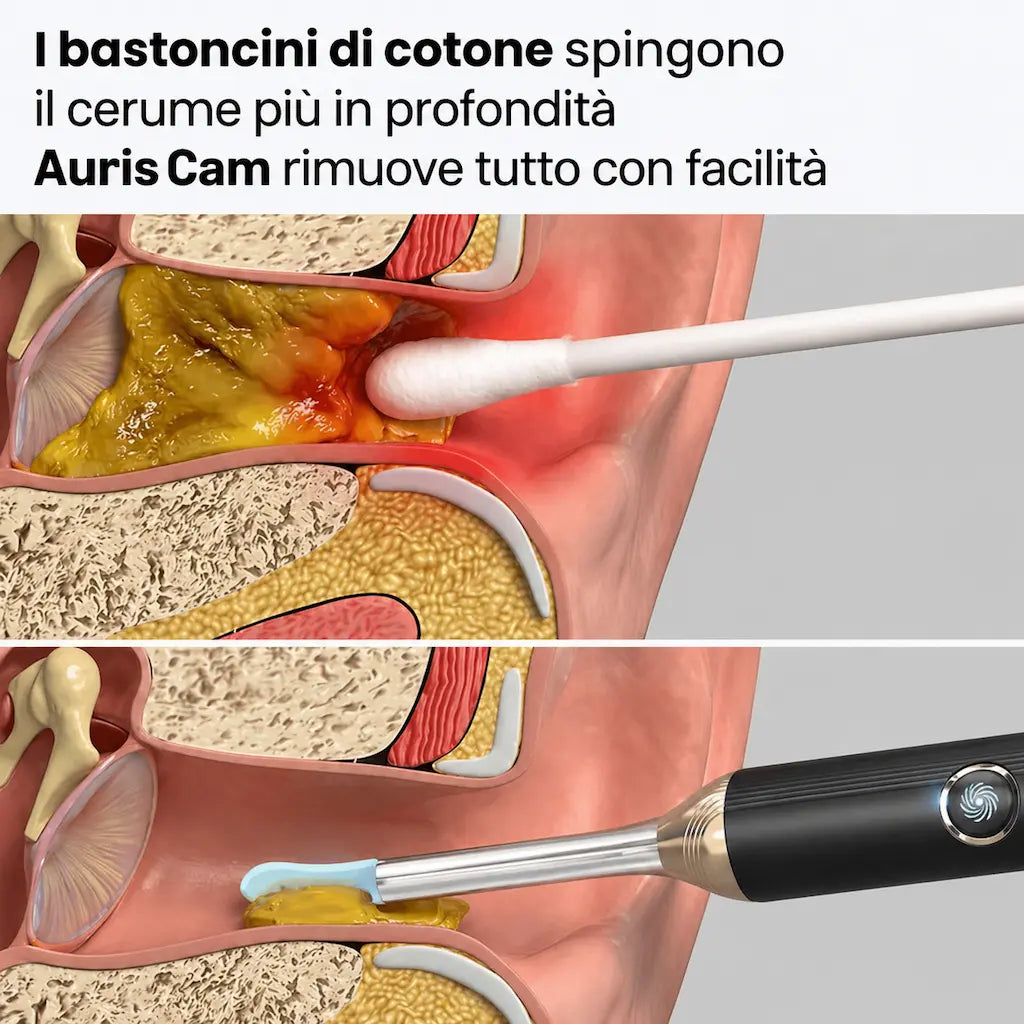 AurisCam - Pulitore auricolare digitale