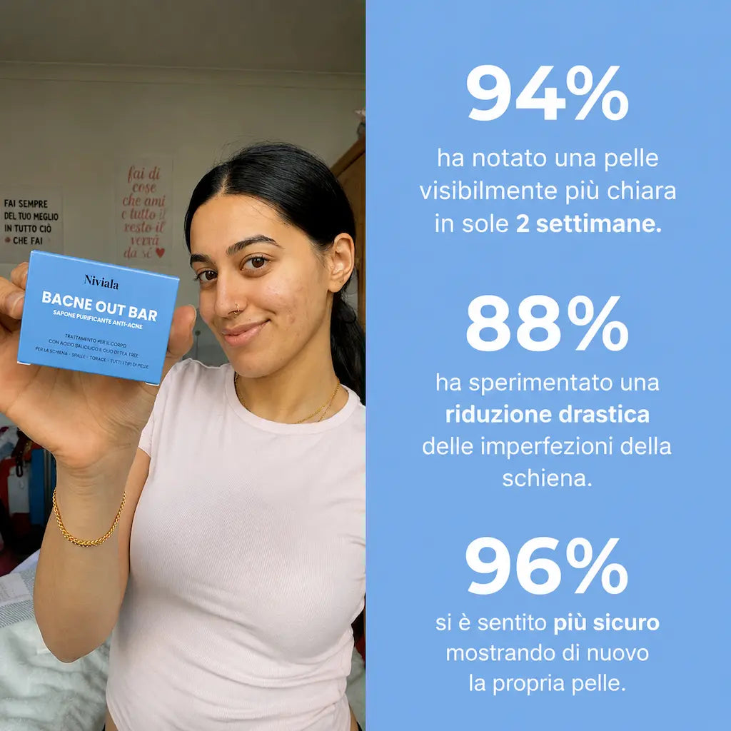 Bacne - acne della schiena
